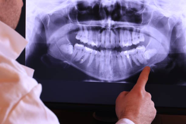 Best Dental Abscess Treatment in Taft, CA